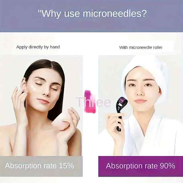 Мезороллер на 540 титанових голках для омолодження та пружності шкіри. - 3 фото товару